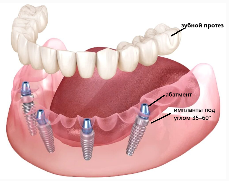 красивая улыбка