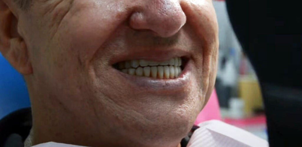 Все делают это неправильно: стоматолог рассказал, как, чем и когда нужно чистить зубы