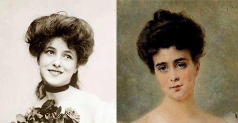 губы в разные времена, увеличение губ, контурная пластика губ