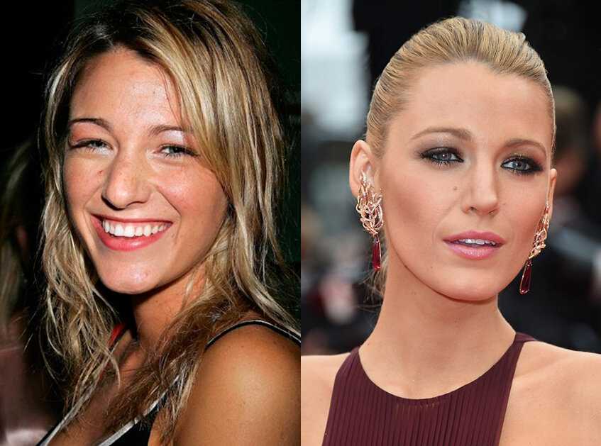 голливудская техника увеличения губ