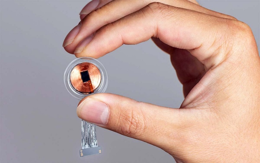 Илон Маск сообщил о выздоровлении первого человека с вживлённым мозговым чипом