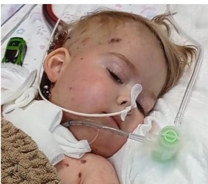 Лёша Саяпин будет жить: мир собрал малышу из Циолковского 61 миллион на новые легкие