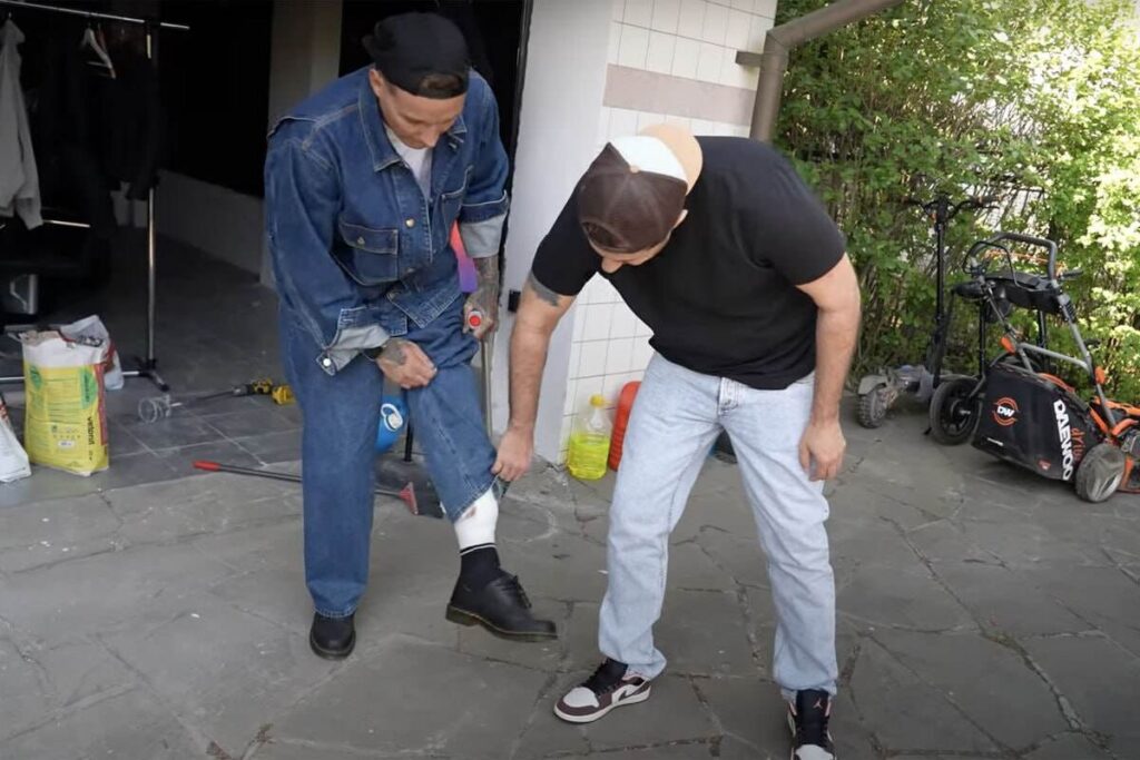 У Эдварда Била диагностировали тяжёлую инфекцию, поражающую кости