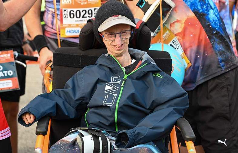 Итальянец с симптомом преждевременного старения умер в 28 лет