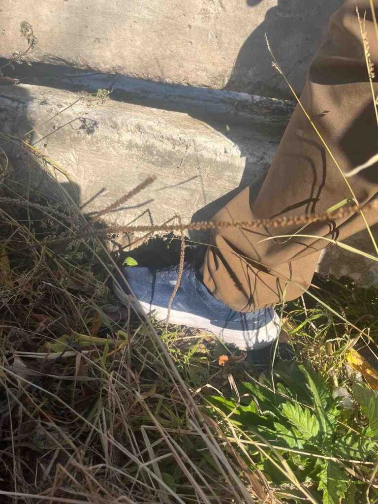 Нога