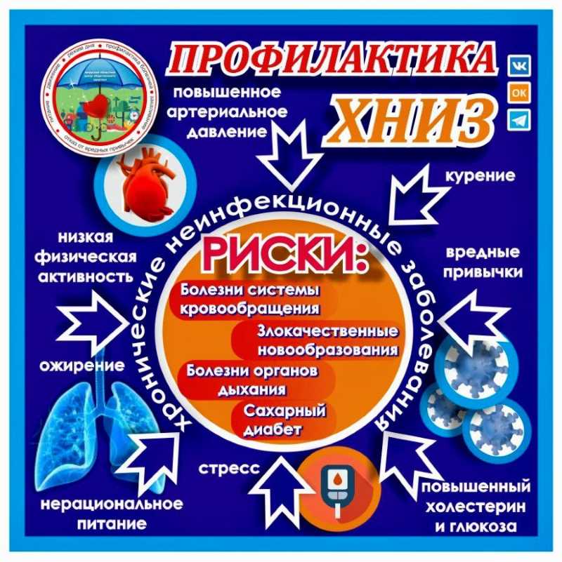 инфографика