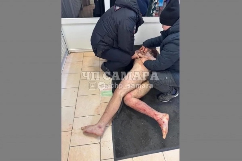 В Самарской области голый мужчина сбежал из больницы, откусил нос продавщице и умер