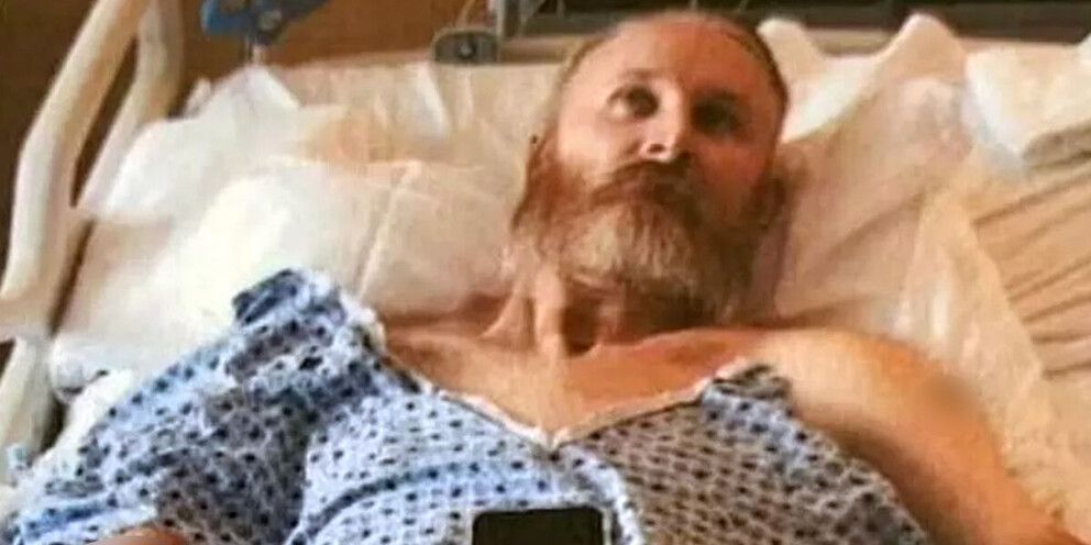 В США мужчина лишился рук и ног после удаления камней в почках