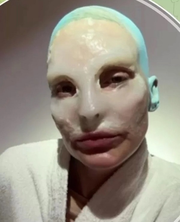 Певица Глюкоза шокировала подписчиков странным видом