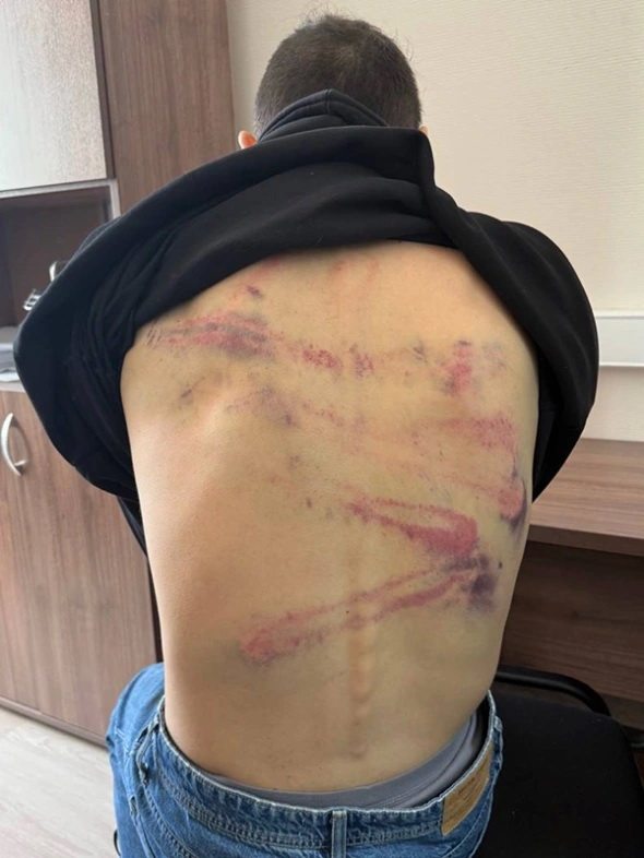 Комик Останин заявил, что его избили дубинками и электрошокером при задержании в Белоруссии