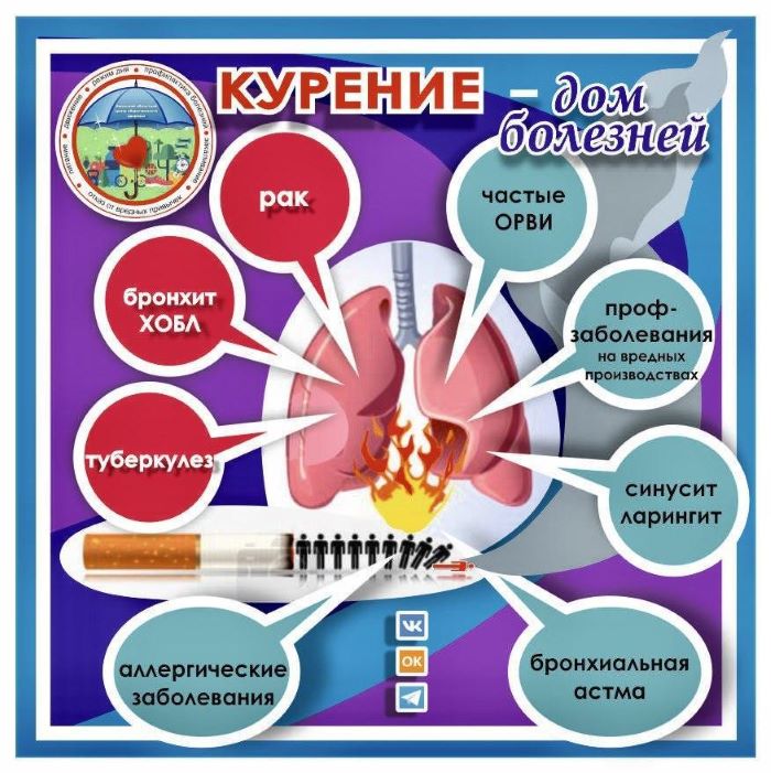 инфографика