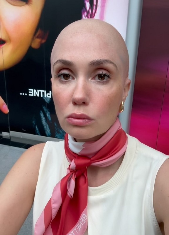 Беременная Агата Муцениеце шокировала поклонников лысой головой