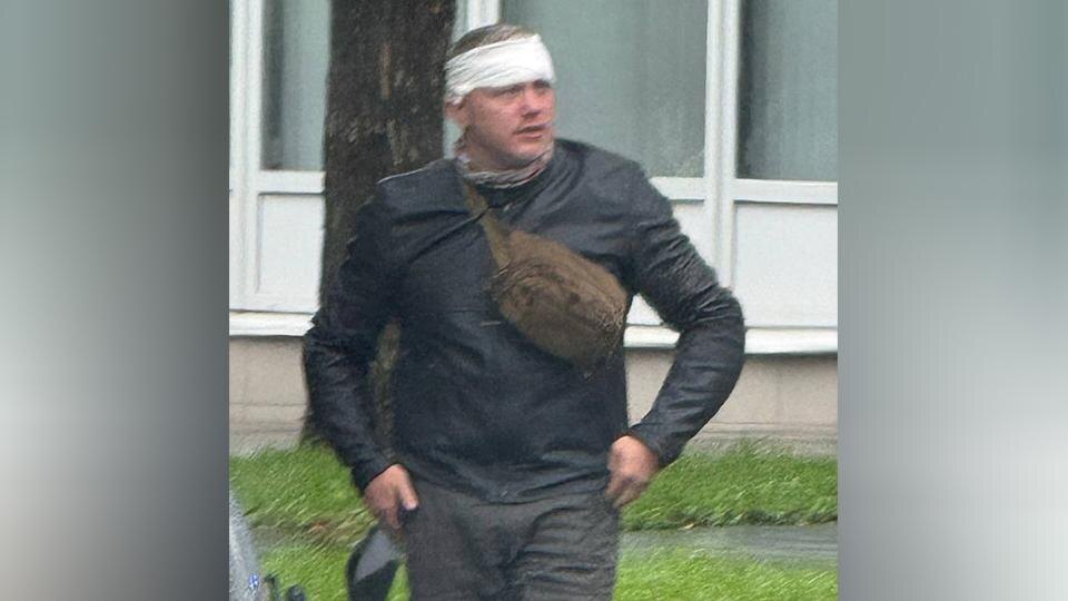 Мужа Елены Блиновской избили после ДТП в Москве