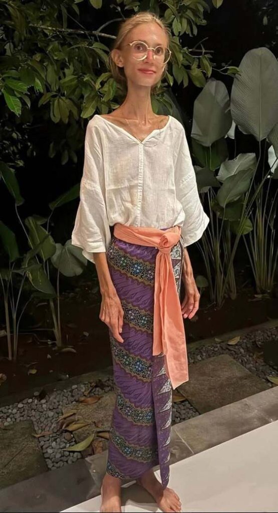 На Бали умерла туристка, которая весила 23 килограмма из-за фруктовой диеты