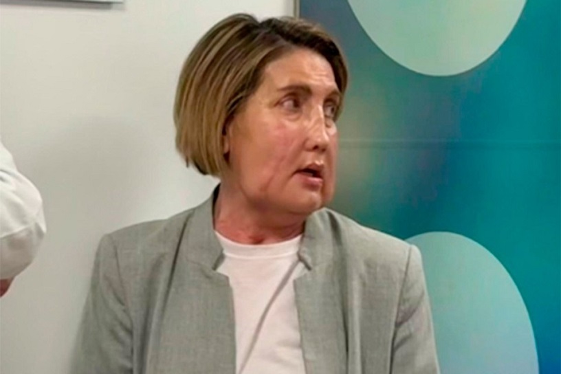 В Испании впервые пересадили пациенту лицо донора после эвтаназии