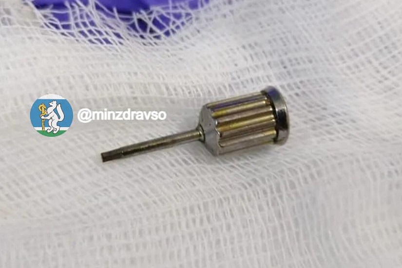 Пациентка проглотила отвёртку на приёме у стоматолога в Екатеринбурге